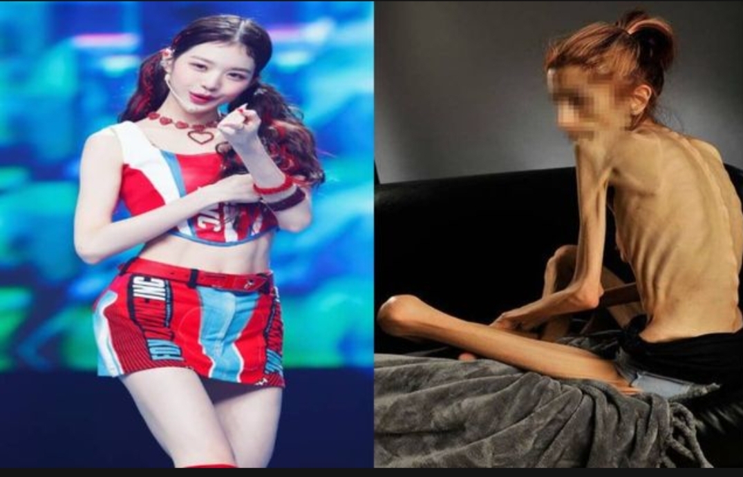  장원영 따라하다가 목숨 위협받는 A양.. 스타들도 심각한 상황