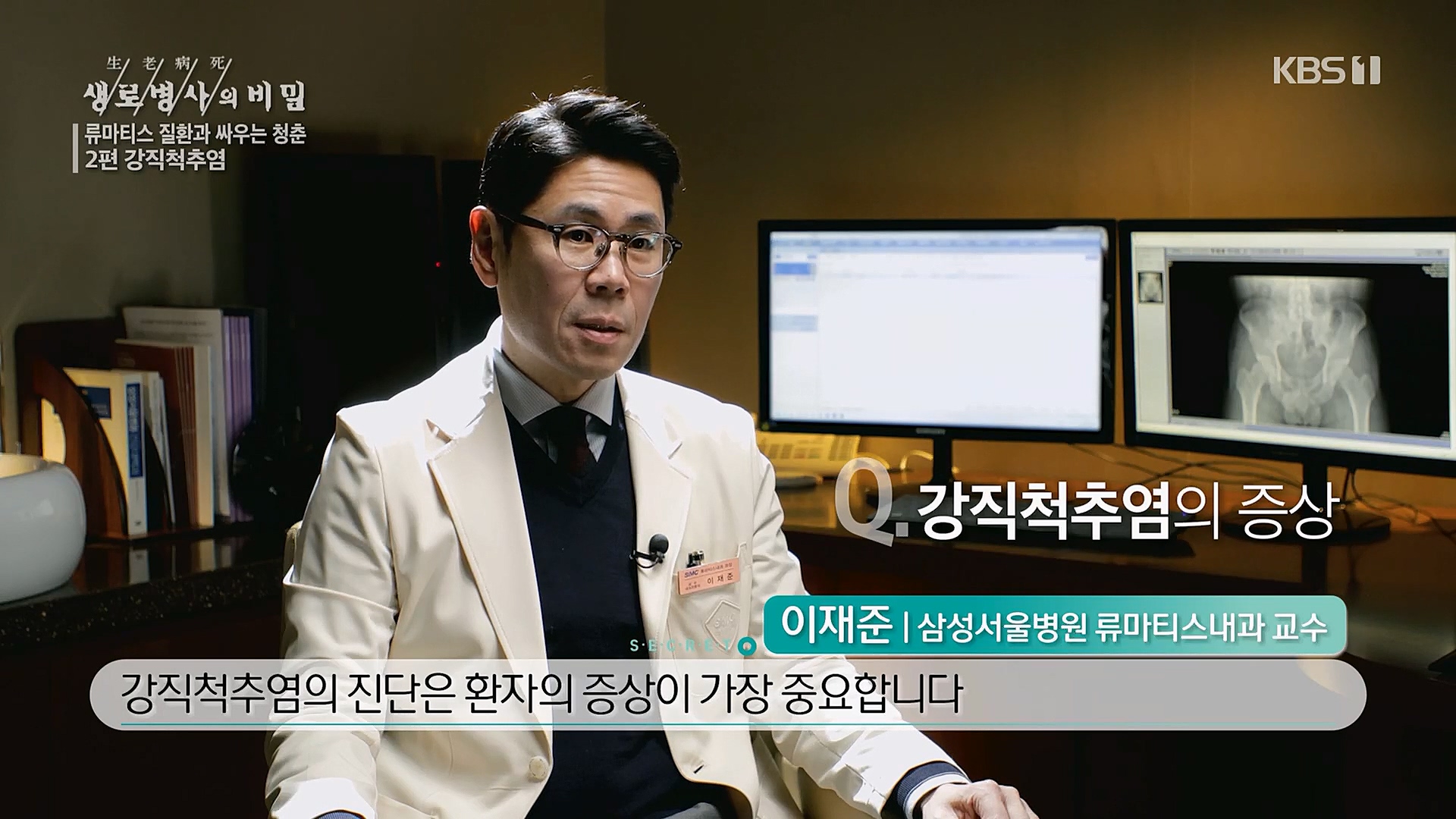 생로병사의 비밀.E861.230322p.H264-F1RST.mp4_20230323_202950.645.jpg