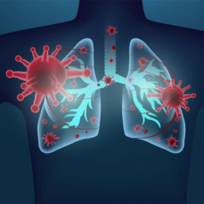 호흡기감염병-마이코플라스마폐렴-중국호흡기-증상