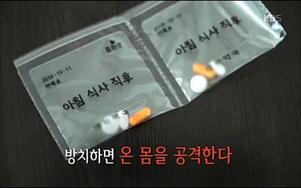 [670회] 생로병사의 비밀 - KBS670회] 생로병사의 비밀.ts_20220505_141650.738.jpg