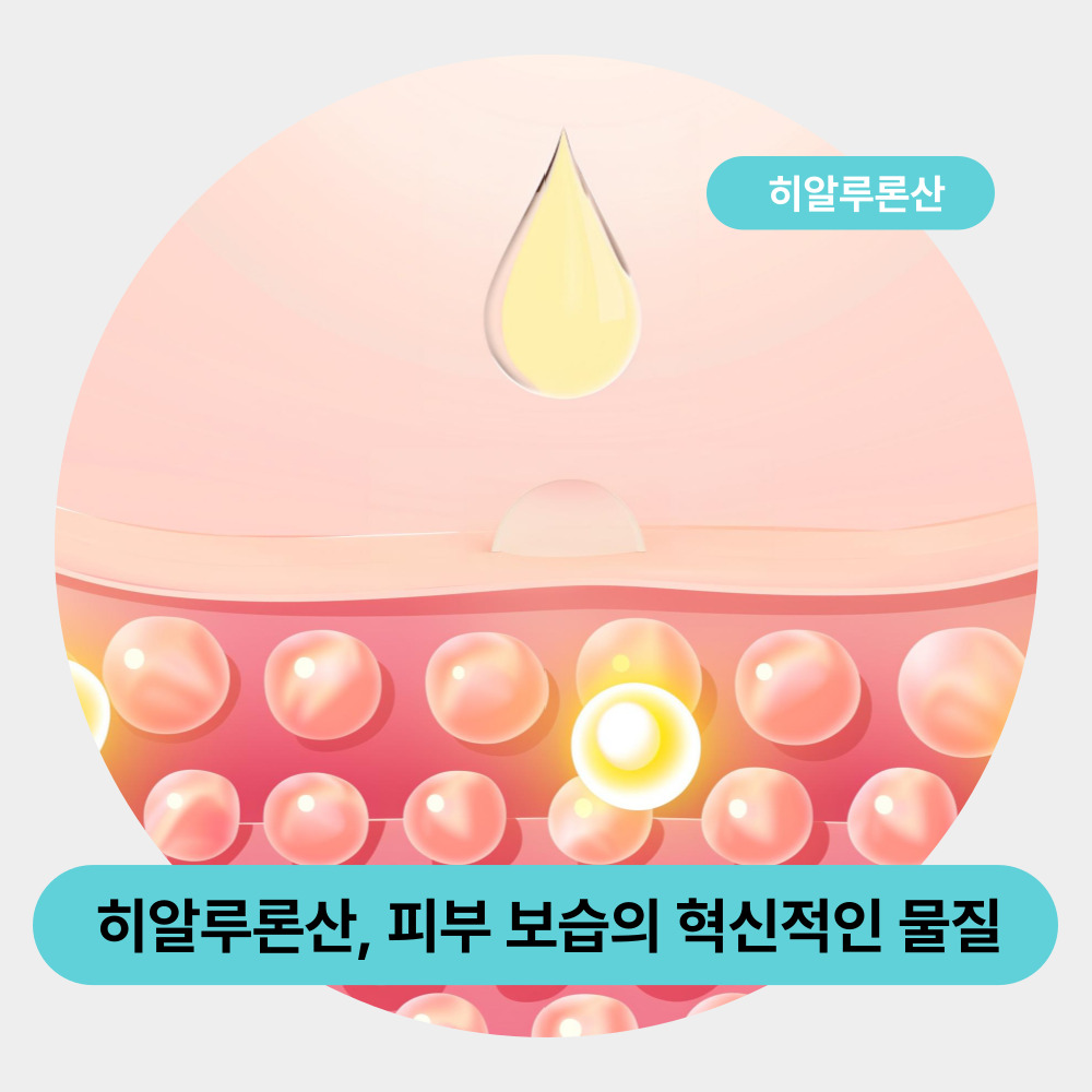 히알루론산, 피부 보습의 혁신적인 물질