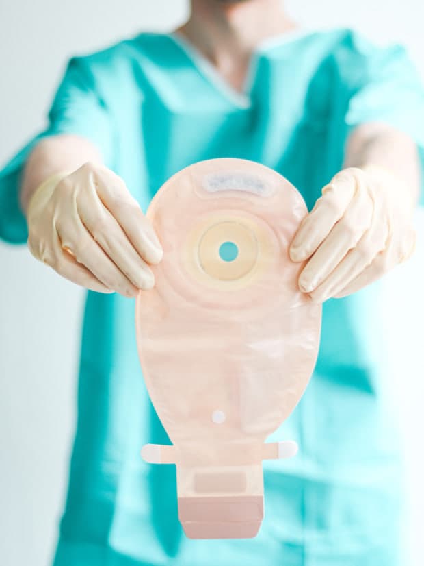 장루(Stoma) 대상자의 간호: 신체·심리적 적응 돕기