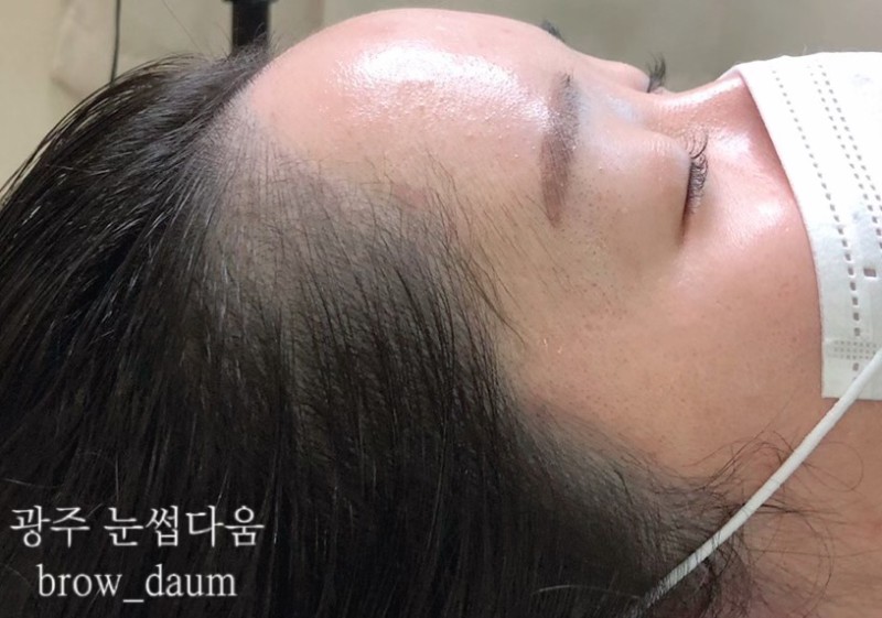  광주 헤어라인문신 잘하는곳 잔흔도 OK "눈썹다움"