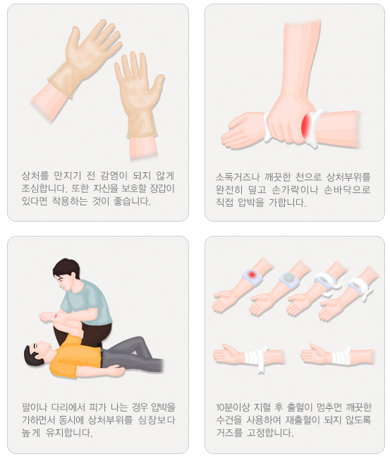  열상 뜻 자상뜻 경정맥 손상 차이
