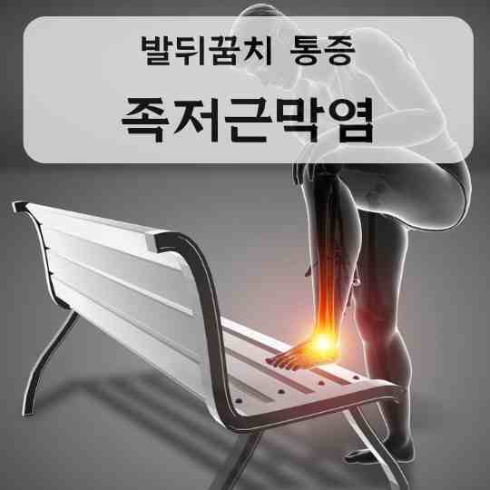 족저근막염