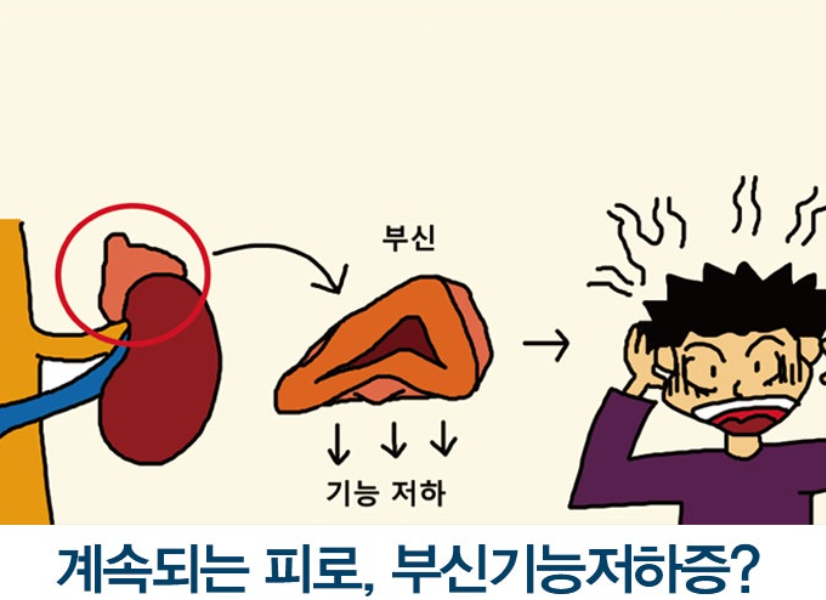 부신 기능 저하