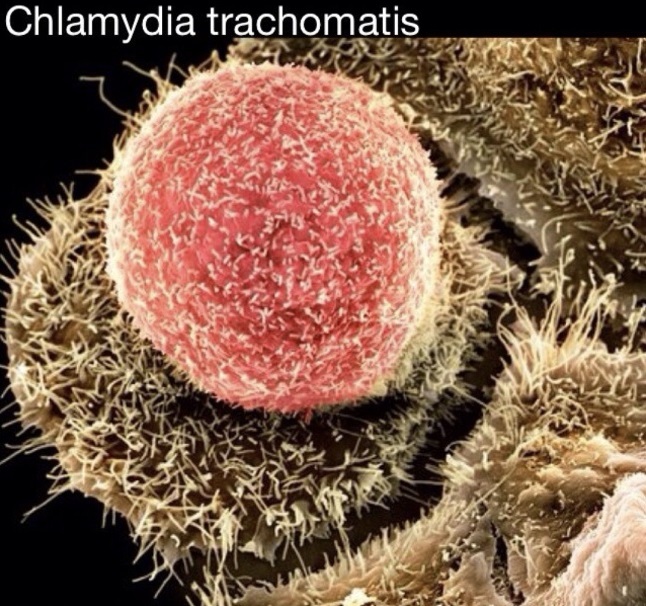 chlamydia trachomatis