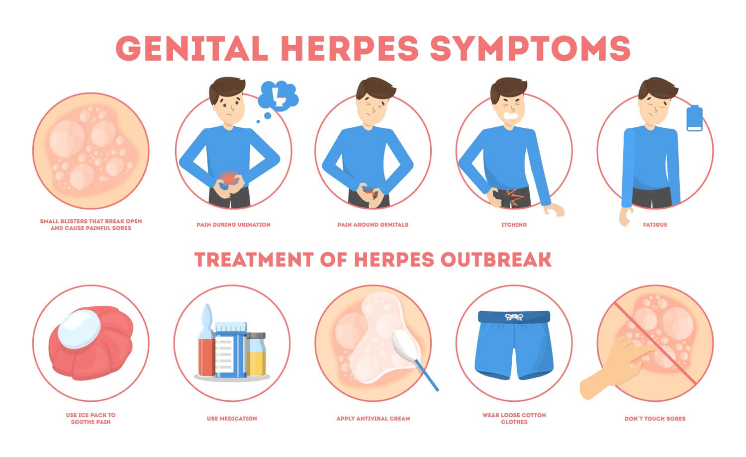 헤르페스2형바이러스-증상-및-치료방법