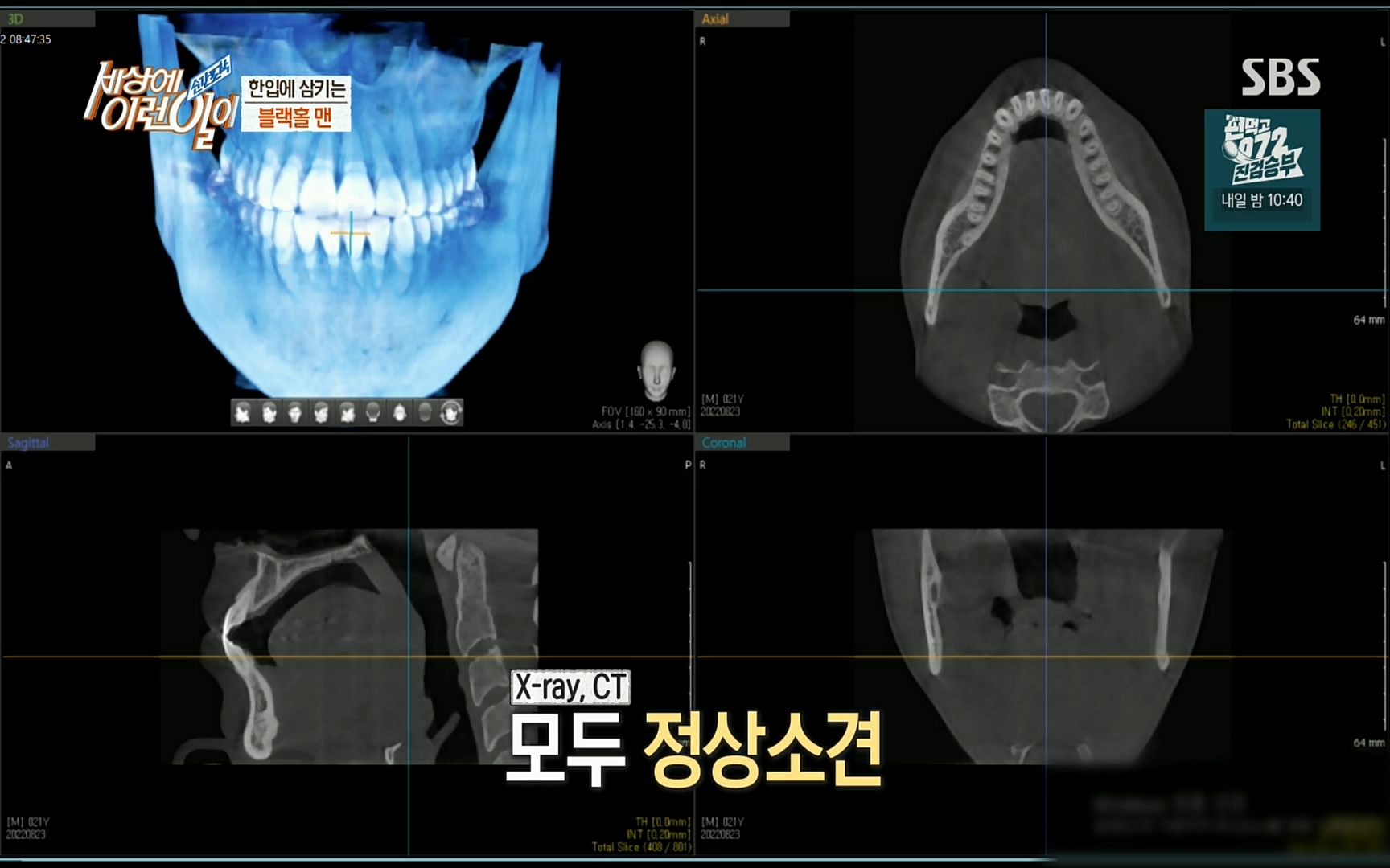 순간포착 세상에 이런일이.E1196.220906p.H264-F1RST.mp4_20220907_203314.779.jpg