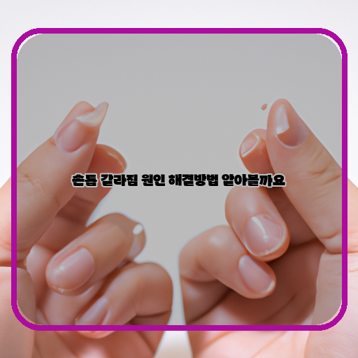 손톱-갈라짐-원인-해결방법-손톱-관리-방법