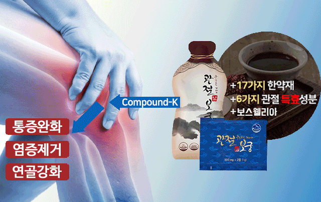  관절보궁 가격 (관절보궁보 궁) 혜택 좋아요