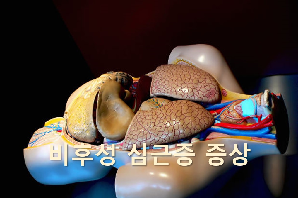  비후성 심근증 증상과 비후성 심근증 원인