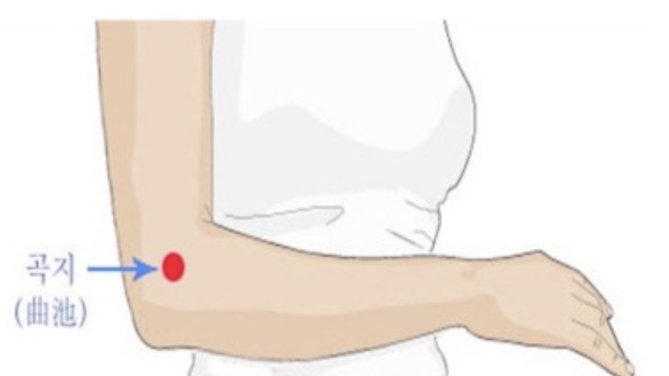 곡지혈-지압