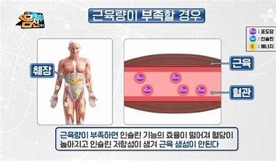 당뇨병 근력운동
