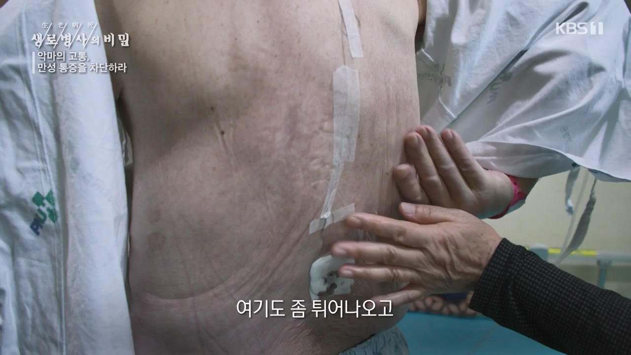 생로병사의 비밀.E897.240125p-NEXT.mp4_20240125_202233.021.jpg