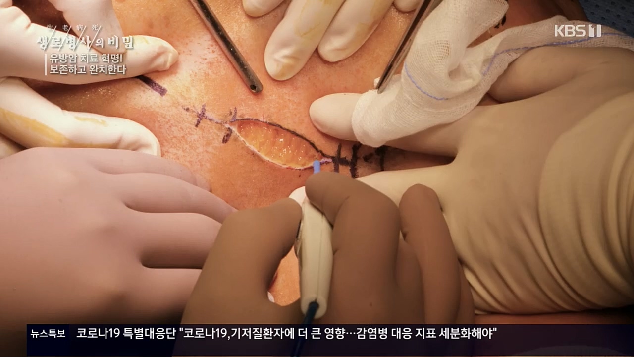 생로병사의 비밀.E845.221131p.H264-F1RST.mp4_20221201_215306.226.jpg