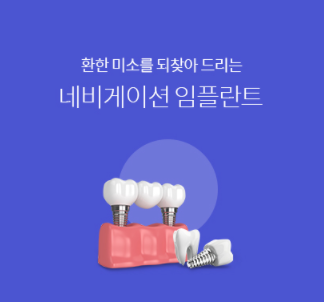  네이게이션 임플란트 전국 최저가 바로가기