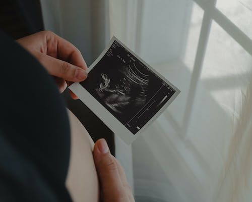  태아 보험 가입요령,관리보상,추천특약 총 정리
