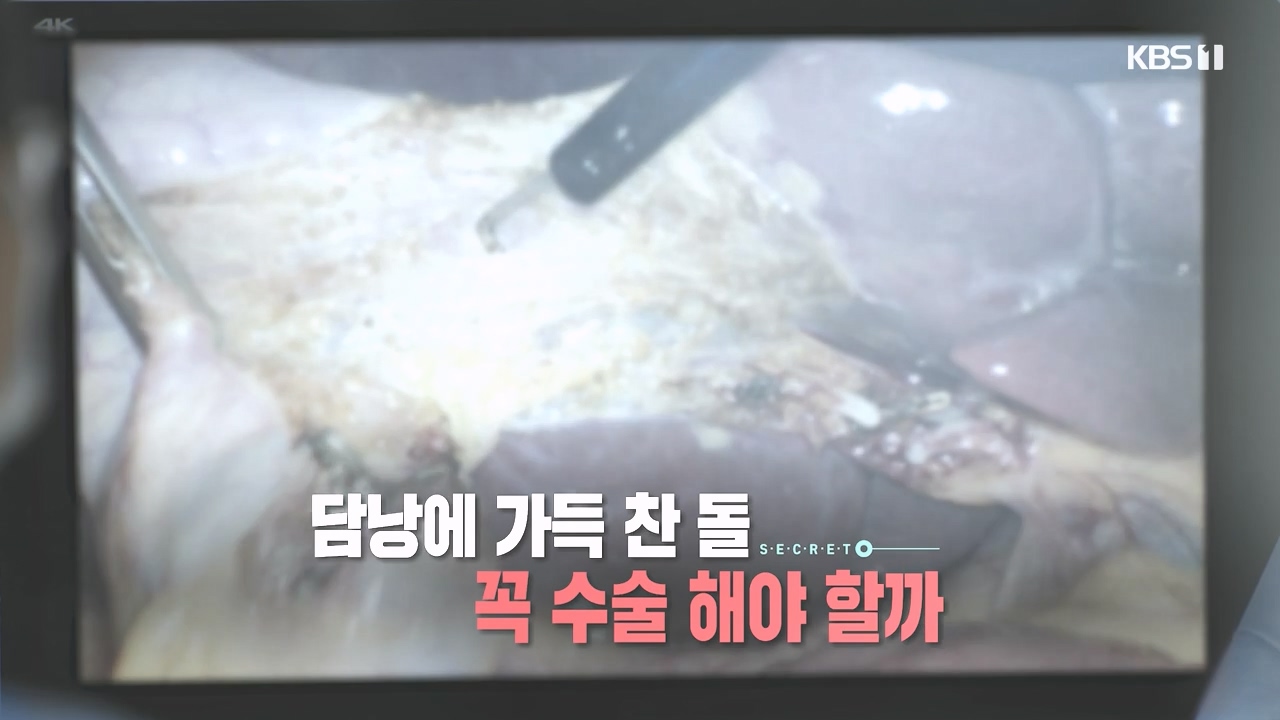 생로병사의 비밀.E886.231019p-NEXT.mp4_20231019_201544.657.jpg