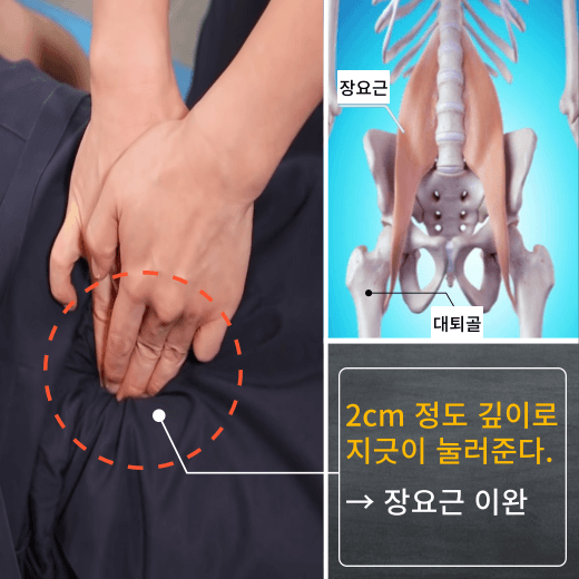 허리-삐끗-했을-때-장요근-이완-마사지