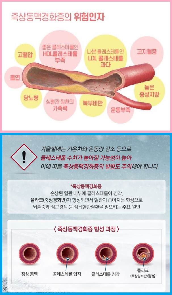 죽상동맥경화증 위험인자, 원인