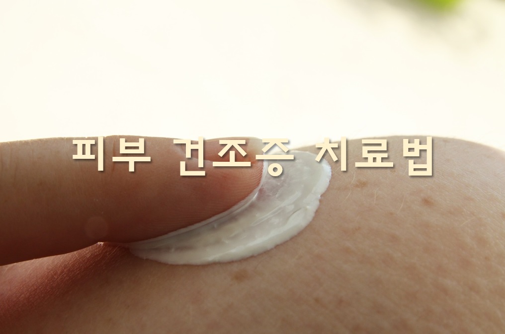  피부 건조증 치료법과 피부 건조증 환자를 위한 겨울철 목욕법