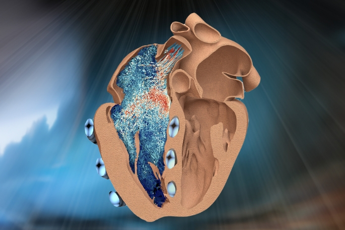 MIT&#44; 심장 우심실 로봇으로 복제 MIT engineers design a robotic replica of the heart’s right chamber