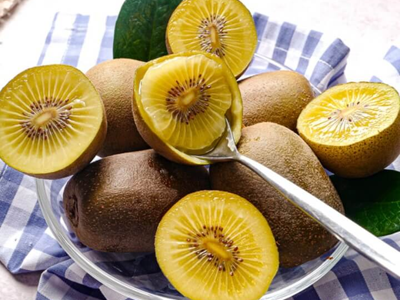키위 효능 10가지 31