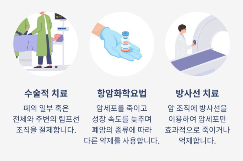 폐암의 치료 수술방법