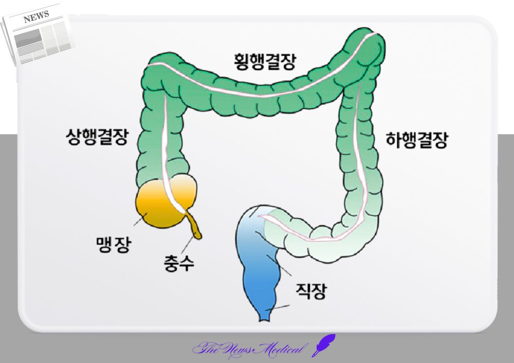 배꼽 아래 극심한 통증