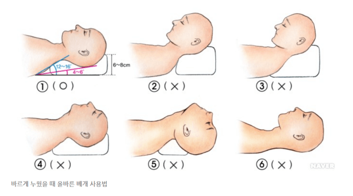 베개사용법-바르게누웠을때