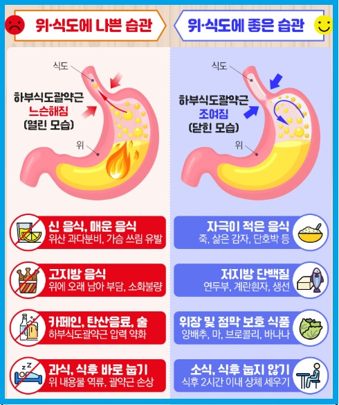 위식도 역류질환 생활식습관
