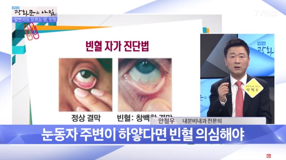  빈혈 증상 빈혈에 좋은 음식 과일