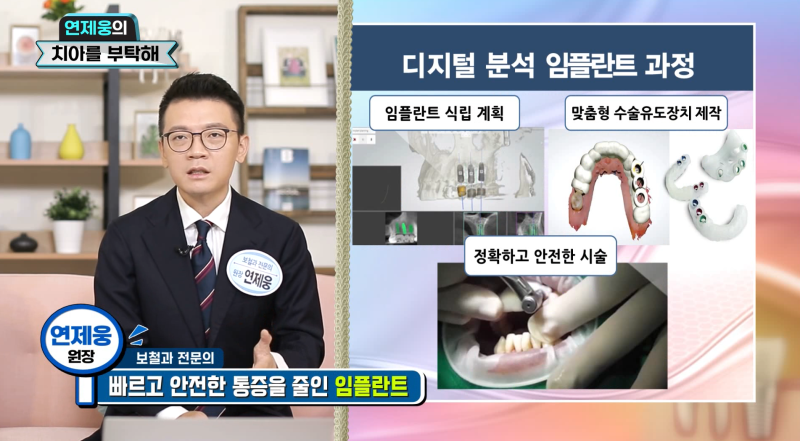 임플란트 시술