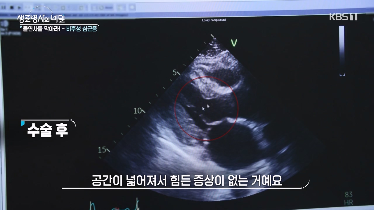 생로병사의 비밀.E912.240523p-NEXT.mp4_20240523_201952.112.jpg