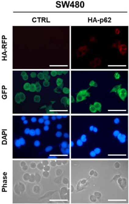  초보 연구자들도 쉽게 할 수 있는 ICC 염색 (ImmunoCytoChemistry Staining) 실험 방법 - 요약 및 정리
