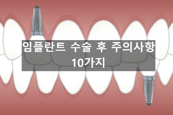  임플란트 수술 후 주의사항 10가지