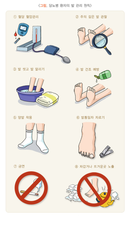 당뇨병-족부병증-발-관리-원칙