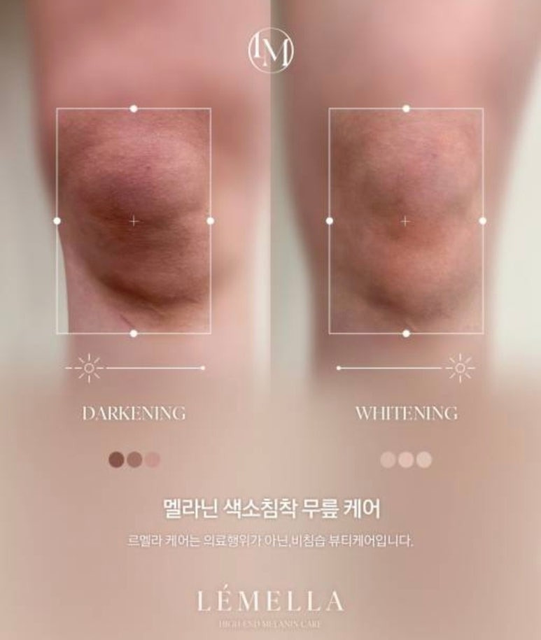 미백 이미지