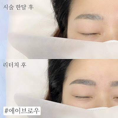  천안눈썹문신 천안반영구 에이브로우에서 시술후부터 탈각후, 리터치후까지 꼭 확인하시고 자연스러운곳을 찾으세요