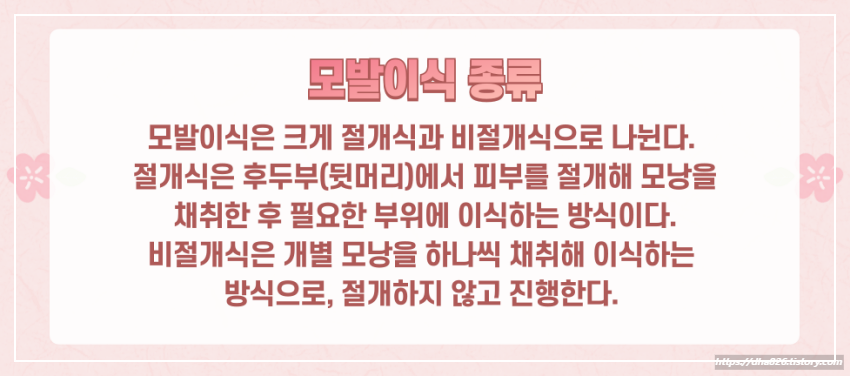 모발이식 종류