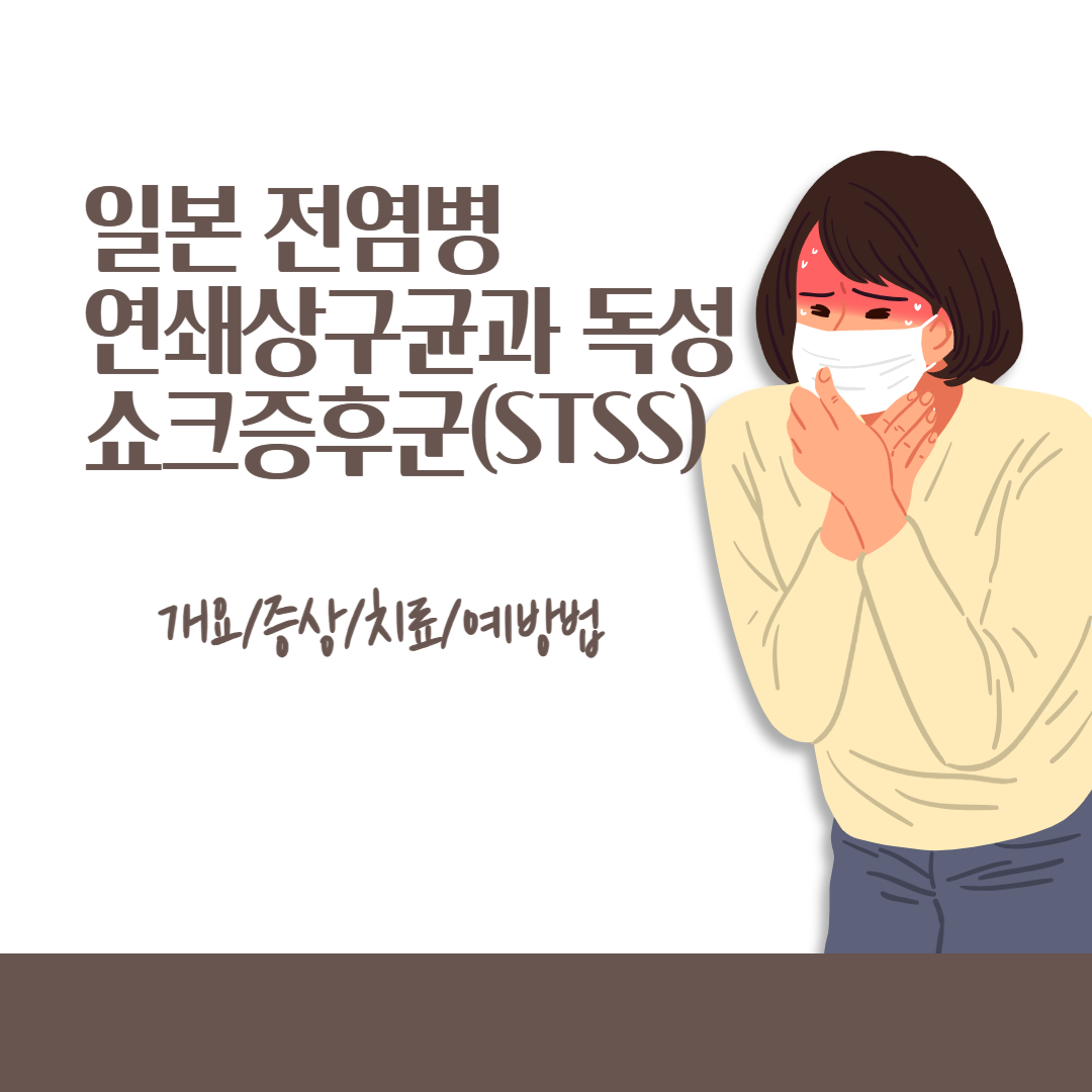 일본 전염병 연쇄상구균과 독성쇼크증후군(STSS) 증상/치료/예방법