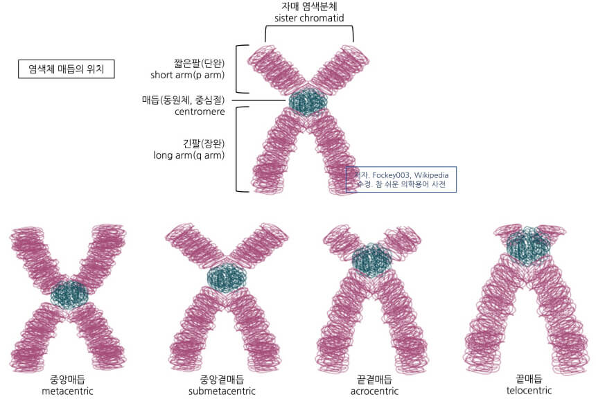 염색체 매듭의 위치. 출처 위키피디아 의학용어 acrocentric 뜻 끝곁매듭-, 선단동원체의, 말단동원체의
