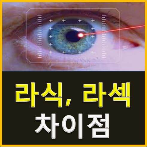  라식과 라섹 차이점 무엇?