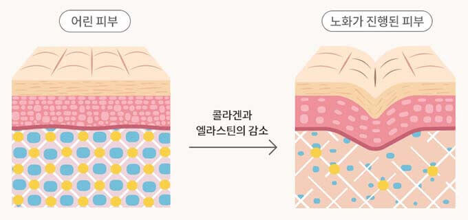 피부 노화