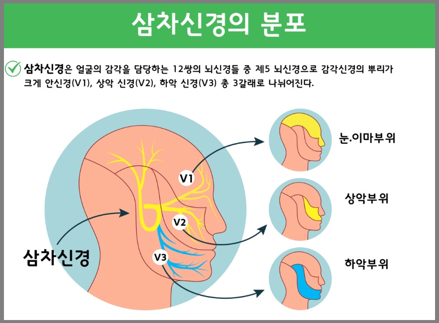 삼차신경의 분포