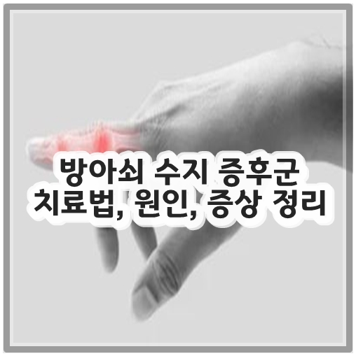 방아쇠 수지 증후군 치료법&#44; 원인&#44; 증상 정리