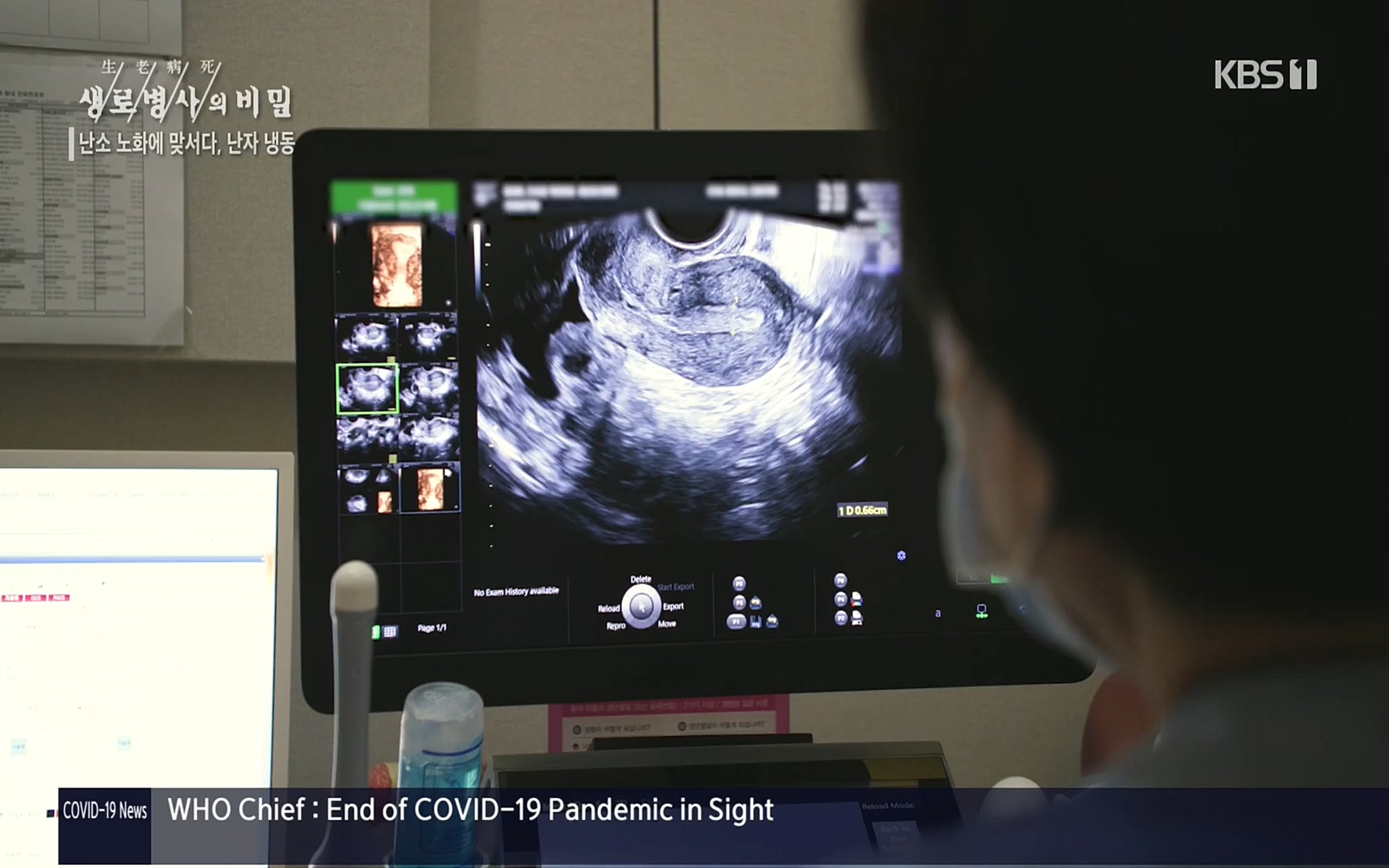 생로병사의 비밀.E836.220921p.H264-F1RST.mp4_20220925_183657.257.jpg