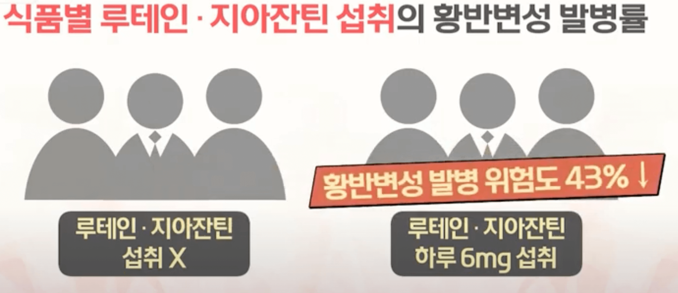 루테인 지아잔틴 황반변성 위험률 감소