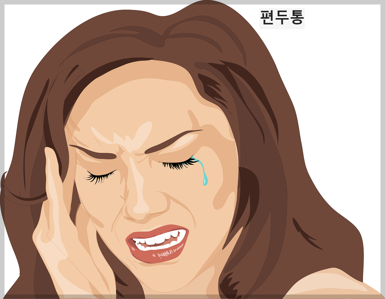 편두통